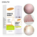 stretch marks removal cream